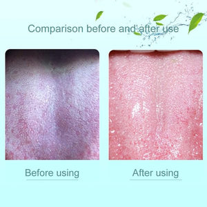 1-Piece Tongue Scraper (Double-Head) | Bad Breath Remover | Oral Hygiene Tool